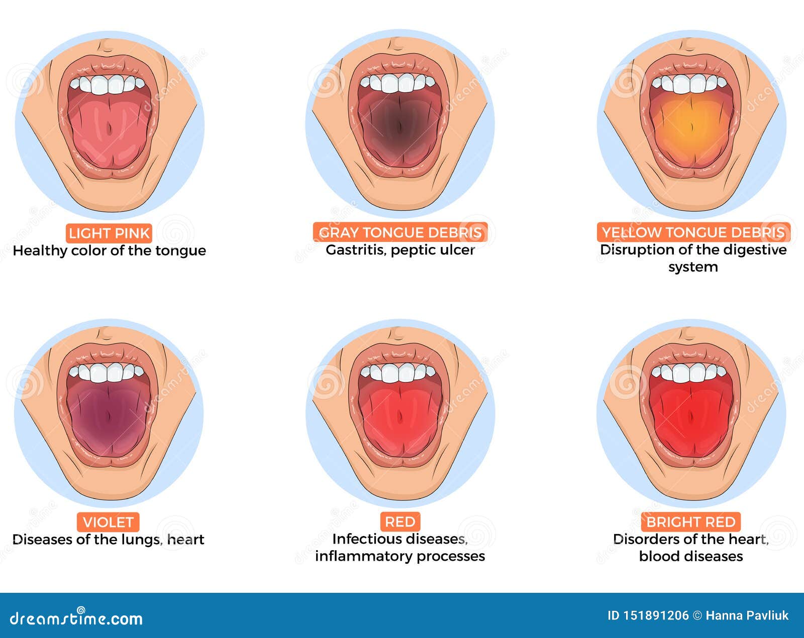  of diagnosis of different diseases